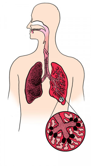 dýchací soustava